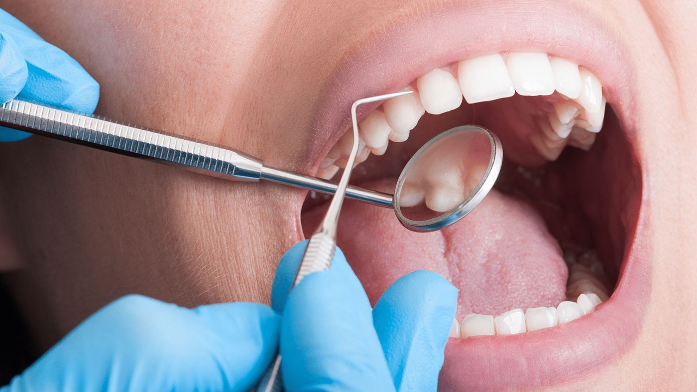 Dental Examination, Apple Dentists